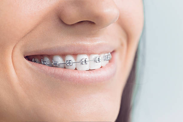 Best Crowns and Bridges  in North Utica, IL